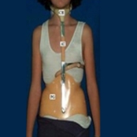 Milwaukee Brace or CTLSO