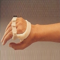 ULNAR DRIFT SPLINT