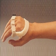 ULNAR DRIFT SPLINT